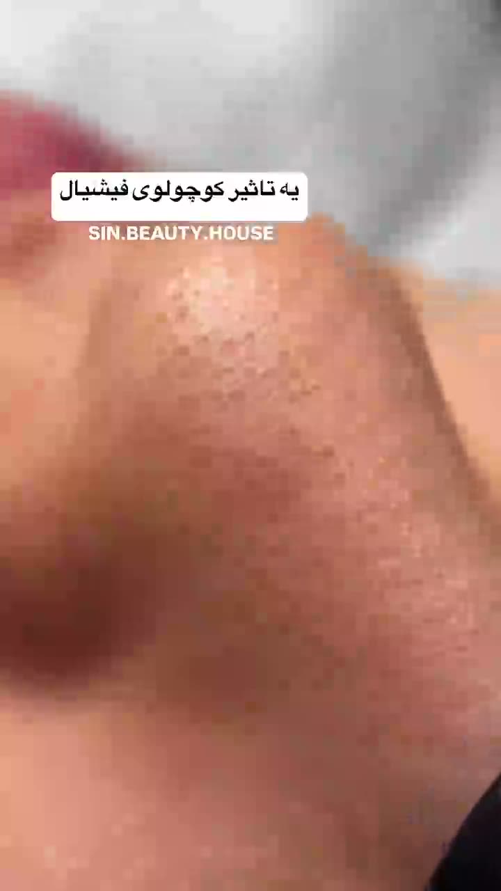 نمونه کار فیشیال