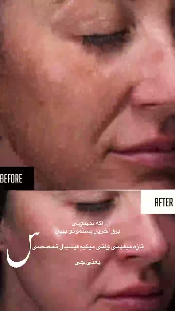 نمونه کار فیشیال