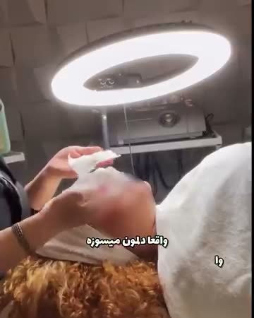 نمونه کار فیشیال