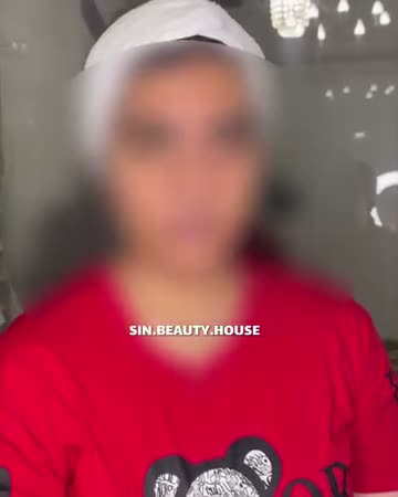 نمونه کار فیشیال